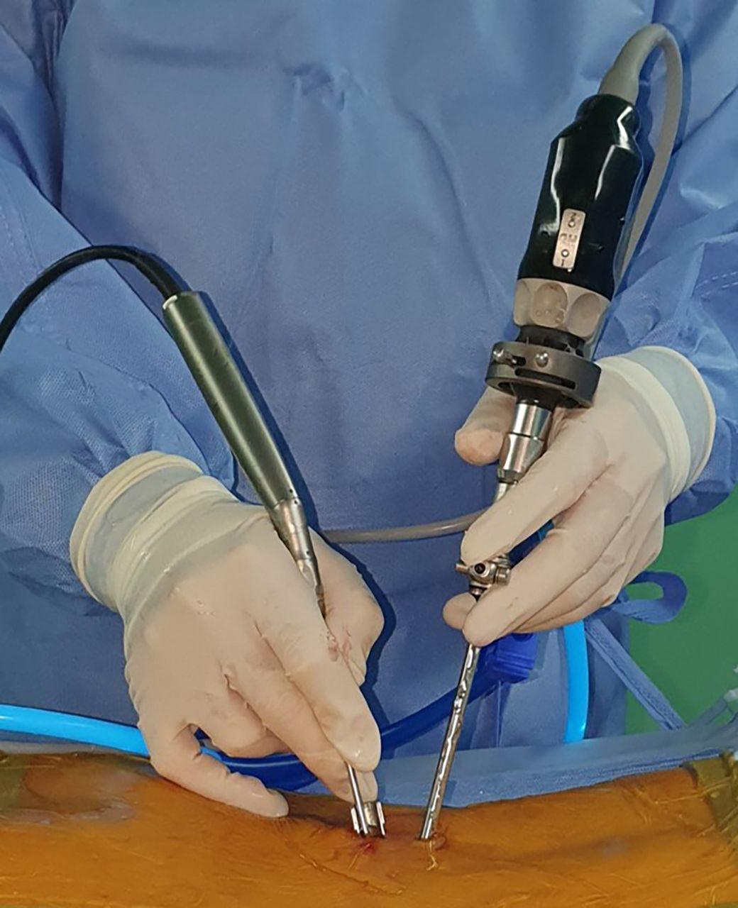 Endoscopic spine surgery instruments